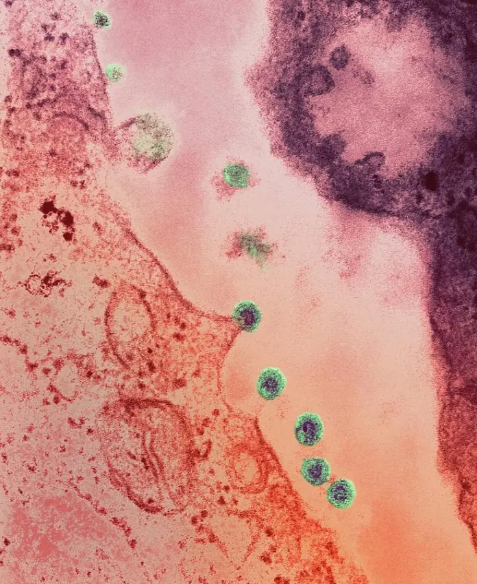 rubella virus